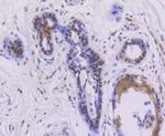 Phospho-Estrogen Receptor alpha (Ser118) Antibody in Immunohistochemistry (Paraffin) (IHC (P))