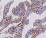 Phospho-Estrogen Receptor alpha (Ser118) Antibody in Immunohistochemistry (Paraffin) (IHC (P))