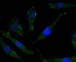 Phospho-TrkB (Tyr817) Antibody in Immunocytochemistry (ICC/IF)