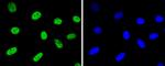 hnRNP K Antibody in Immunocytochemistry (ICC/IF)