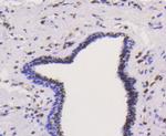 hnRNP K Antibody in Immunohistochemistry (Paraffin) (IHC (P))