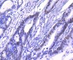 Ku80 Antibody in Immunohistochemistry (Paraffin) (IHC (P))