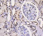 Ku80 Antibody in Immunohistochemistry (Paraffin) (IHC (P))