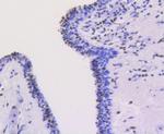 Ku80 Antibody in Immunohistochemistry (Paraffin) (IHC (P))