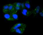 Radixin Antibody in Immunocytochemistry (ICC/IF)