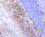 Radixin Antibody in Immunohistochemistry (Paraffin) (IHC (P))