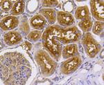 Radixin Antibody in Immunohistochemistry (Paraffin) (IHC (P))