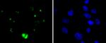 WT1 Antibody in Immunocytochemistry (ICC/IF)