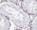 WT1 Antibody in Immunohistochemistry (Paraffin) (IHC (P))