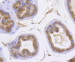 Catenin alpha-1 Antibody in Immunohistochemistry (Paraffin) (IHC (P))