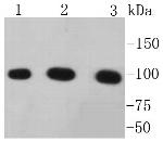 Catenin alpha-1 Antibody in Western Blot (WB)