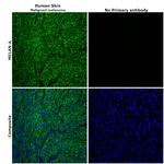 Melan-A Antibody in Immunohistochemistry (Paraffin) (IHC (P))