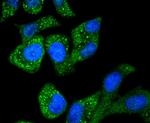 Asparagine Synthetase Antibody in Immunocytochemistry (ICC/IF)