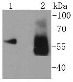 Asparagine Synthetase Antibody in Western Blot (WB)