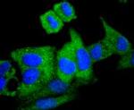 ATG7 Antibody in Immunocytochemistry (ICC/IF)