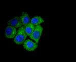 ATG7 Antibody in Immunocytochemistry (ICC/IF)