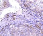 ATG7 Antibody in Immunohistochemistry (Paraffin) (IHC (P))