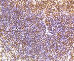 Phospho-SMC1 (Ser957) Antibody in Immunohistochemistry (Paraffin) (IHC (P))