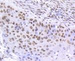 Phospho-SMC1 (Ser957) Antibody in Immunohistochemistry (Paraffin) (IHC (P))