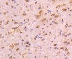 CD13 Antibody in Immunohistochemistry (Paraffin) (IHC (P))