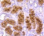 CD13 Antibody in Immunohistochemistry (Paraffin) (IHC (P))