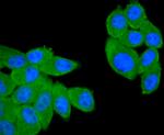 CD21 Antibody in Immunocytochemistry (ICC/IF)