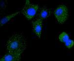 CD21 Antibody in Immunocytochemistry (ICC/IF)