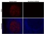 CD21 Antibody in Immunohistochemistry (Paraffin) (IHC (P))