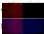 CD21 Antibody in Immunohistochemistry (Paraffin) (IHC (P))