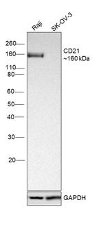 CD21 Antibody in Western Blot (WB)