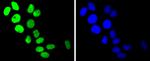 TOP1 Antibody in Immunocytochemistry (ICC/IF)