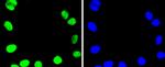 TOP1 Antibody in Immunocytochemistry (ICC/IF)