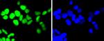 TOP1 Antibody in Immunocytochemistry (ICC/IF)