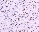 TOP1 Antibody in Immunohistochemistry (Paraffin) (IHC (P))