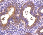 DKK1 Antibody in Immunohistochemistry (Paraffin) (IHC (P))