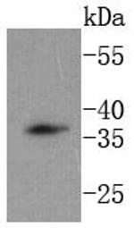 DKK1 Antibody in Western Blot (WB)