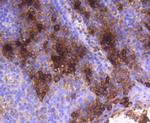 Tryptase Antibody in Immunohistochemistry (Paraffin) (IHC (P))