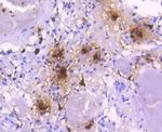 Tryptase Antibody in Immunohistochemistry (Paraffin) (IHC (P))