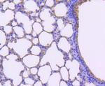 Tryptase Antibody in Immunohistochemistry (Paraffin) (IHC (P))