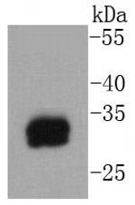 Tryptase Antibody in Western Blot (WB)