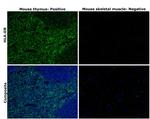 HLA-DR Antibody