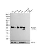 HLA-DR Antibody