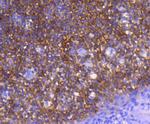 GART Antibody in Immunohistochemistry (Paraffin) (IHC (P))