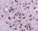 MEKK2 Antibody in Immunohistochemistry (Paraffin) (IHC (P))