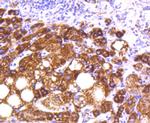 MTCO2 Antibody in Immunohistochemistry (Paraffin) (IHC (P))