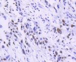 TCF7L2 Antibody in Immunohistochemistry (Paraffin) (IHC (P))