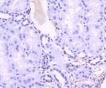 TCF7L2 Antibody in Immunohistochemistry (Paraffin) (IHC (P))