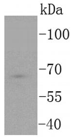 TCF7L2 Antibody in Western Blot (WB)