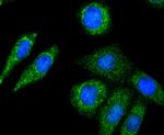 DIABLO Antibody in Immunocytochemistry (ICC/IF)