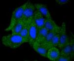 AKAP14 Antibody in Immunocytochemistry (ICC/IF)